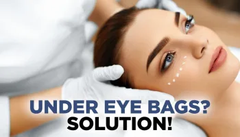 Under Eye Bags? SOLUTION!